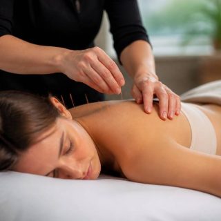 Acupuncteur salaire : combien gagne un acupuncteur en France ?